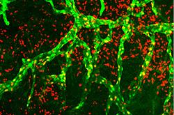 Lymphatic vessels overgrowing in mouse cornea in response to galectin-8. The lymphatic vessels are in green.